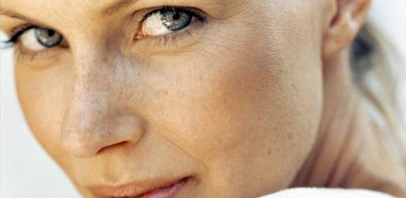 Cremes anti manchas rosto eficazes